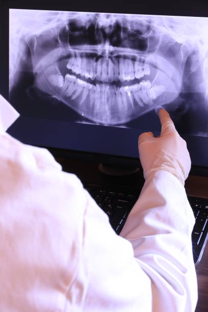 Best Emergency Dental Care for Abscessed Tooth in Bruceville Eddy, TX