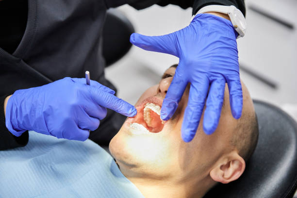 Best Emergency Dentist for Knocked-Out Tooth in Bruceville Eddy, TX
